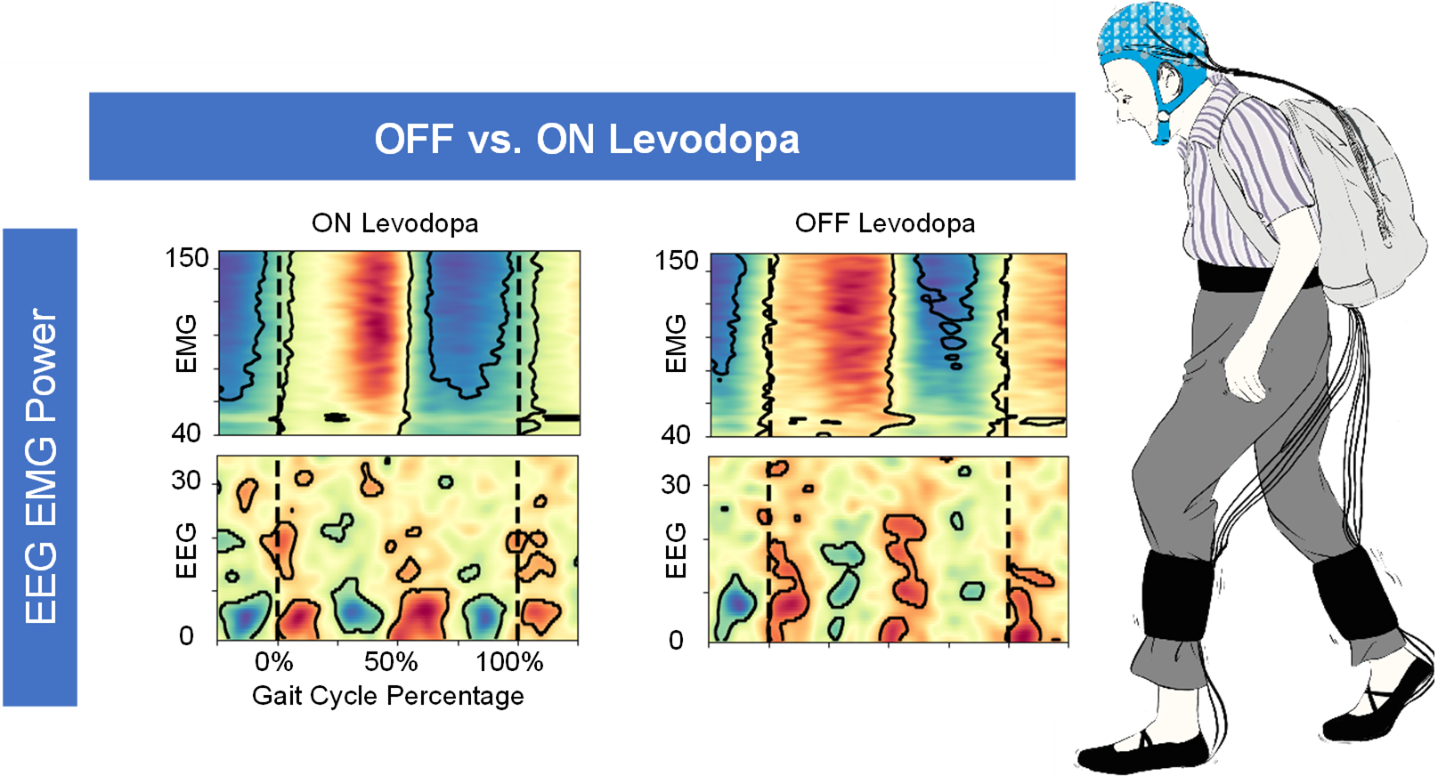 Experimental setup and modulation of EEG and EMG power during walking in both OFF and ON medication states.