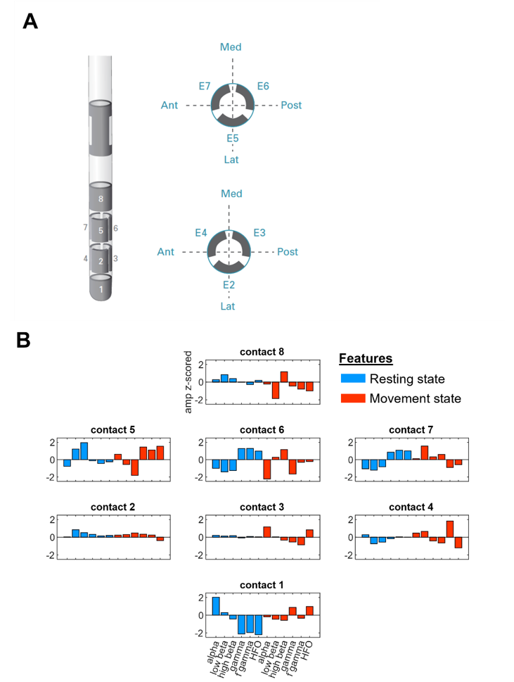 At the top, there are three cartoons of a Deep Brain Stimulation lead with eight contacts. At the bottom, there are coloured graphs showing different kinds of neuronal activity.