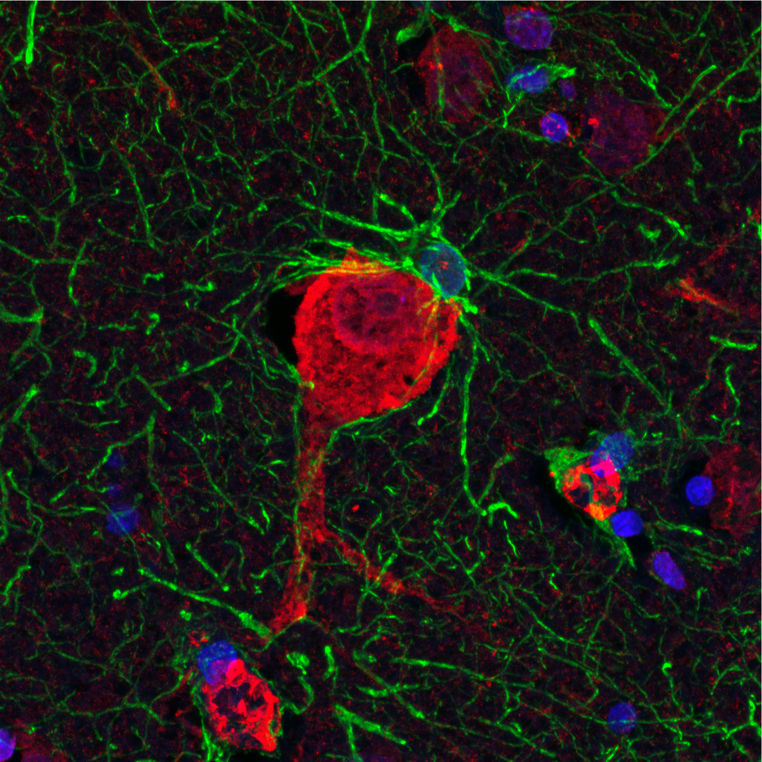 Microscope image of a human cholinergic interneuron with a 'satellite' astrocyte.