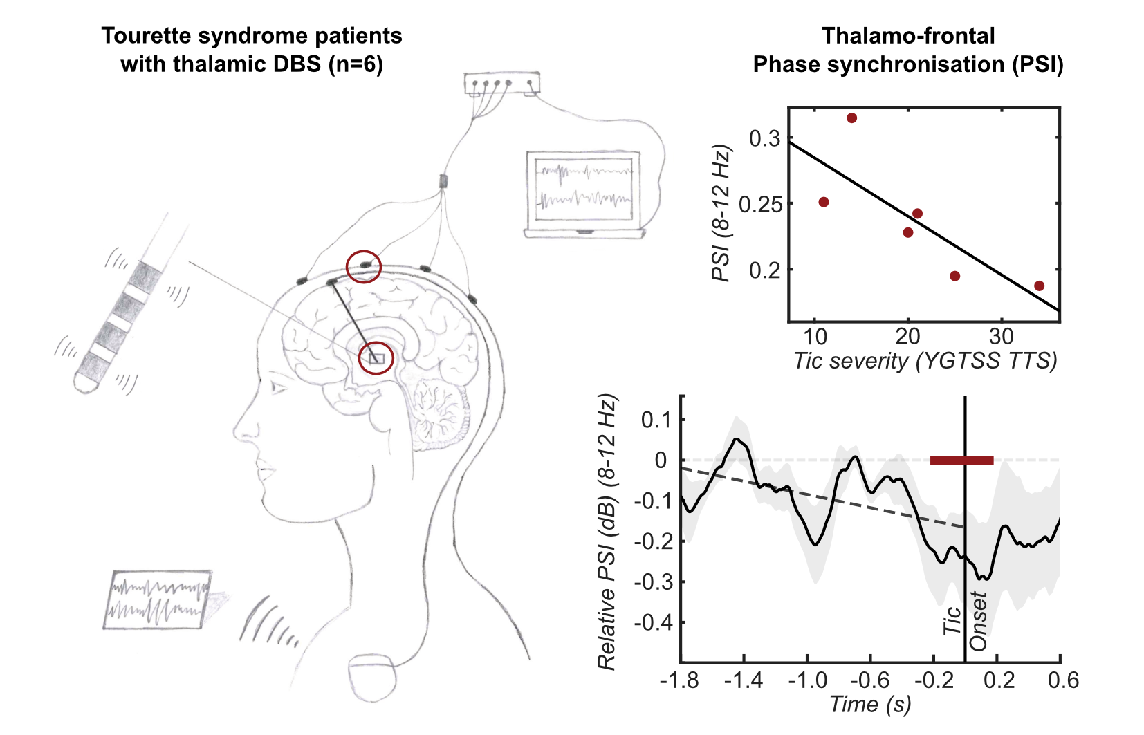 Thalamo-frontal functional connectivity patterns in Tourette Syndrome.