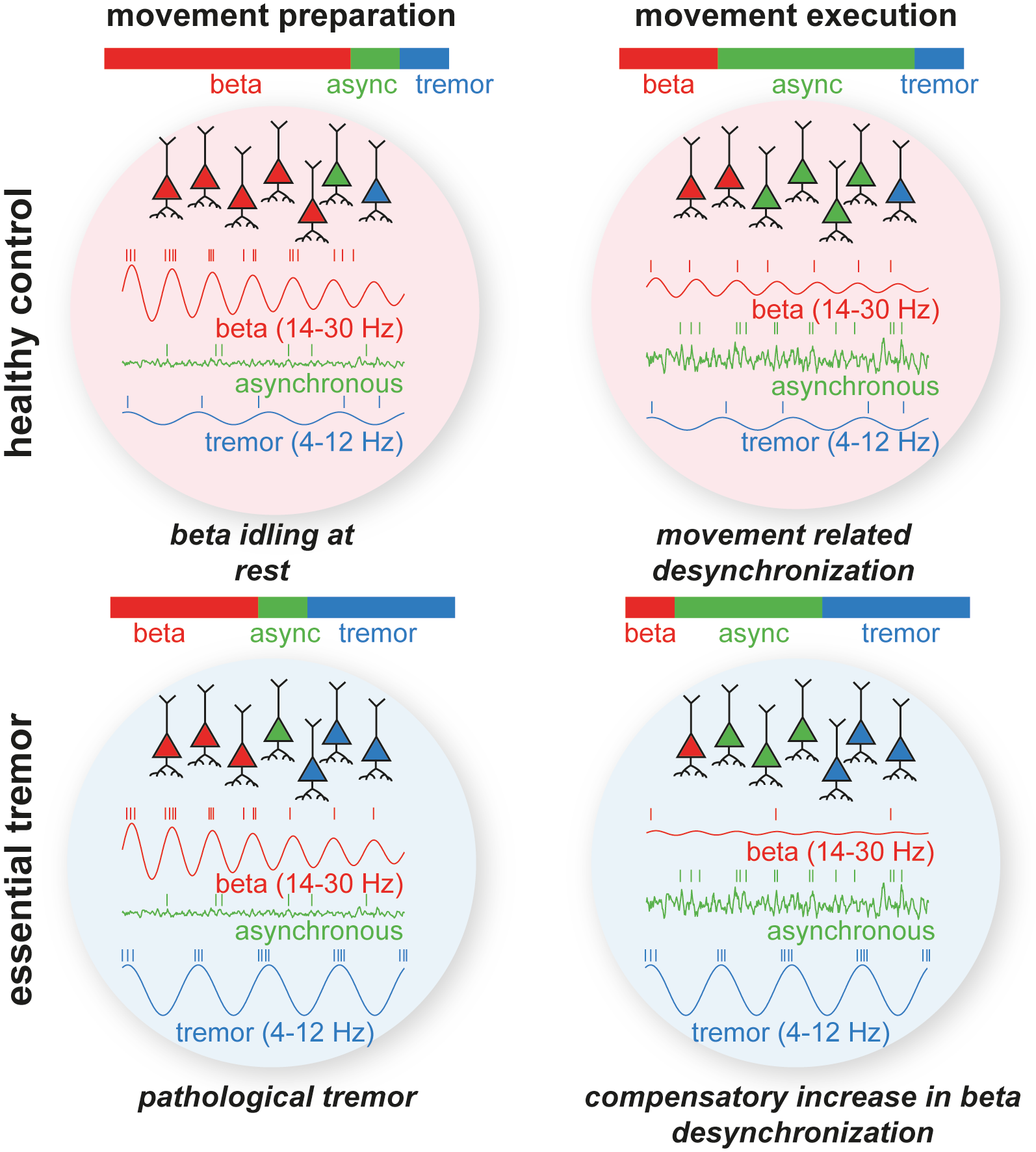 four panels showing health controls and patients in movement preparation and execution, showing an overview of the results using graphs of beta/asynchrony and tremor, and plots of neuronal firing.