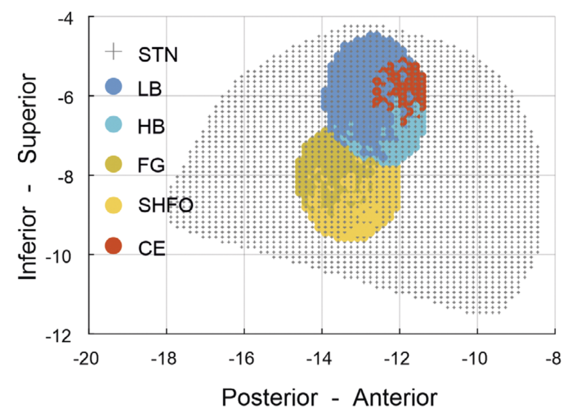 This image shows spheres of color representing the location of brain activity at different frequencies in the brain region targeted by deep brain stimulation in Parkinson’s.