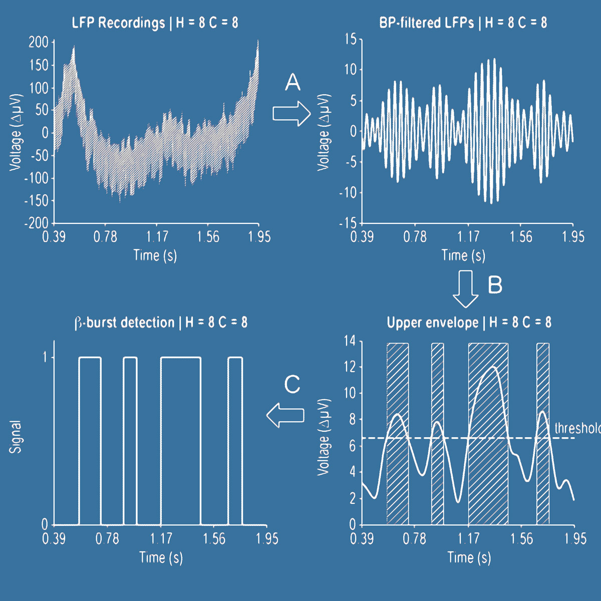 four panels showing a flow from local field potential recordings, to band-pass-filtered signal, upper enveloper filter, and finally periods of beta frequency bursts