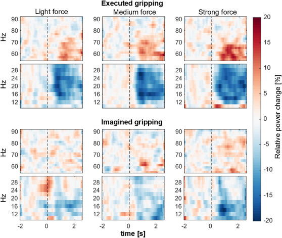 Time-frequency spectrograms of neuronal activity in the subthalamic nucleus during contralateral real gripping (above) and imagined gripping (below).