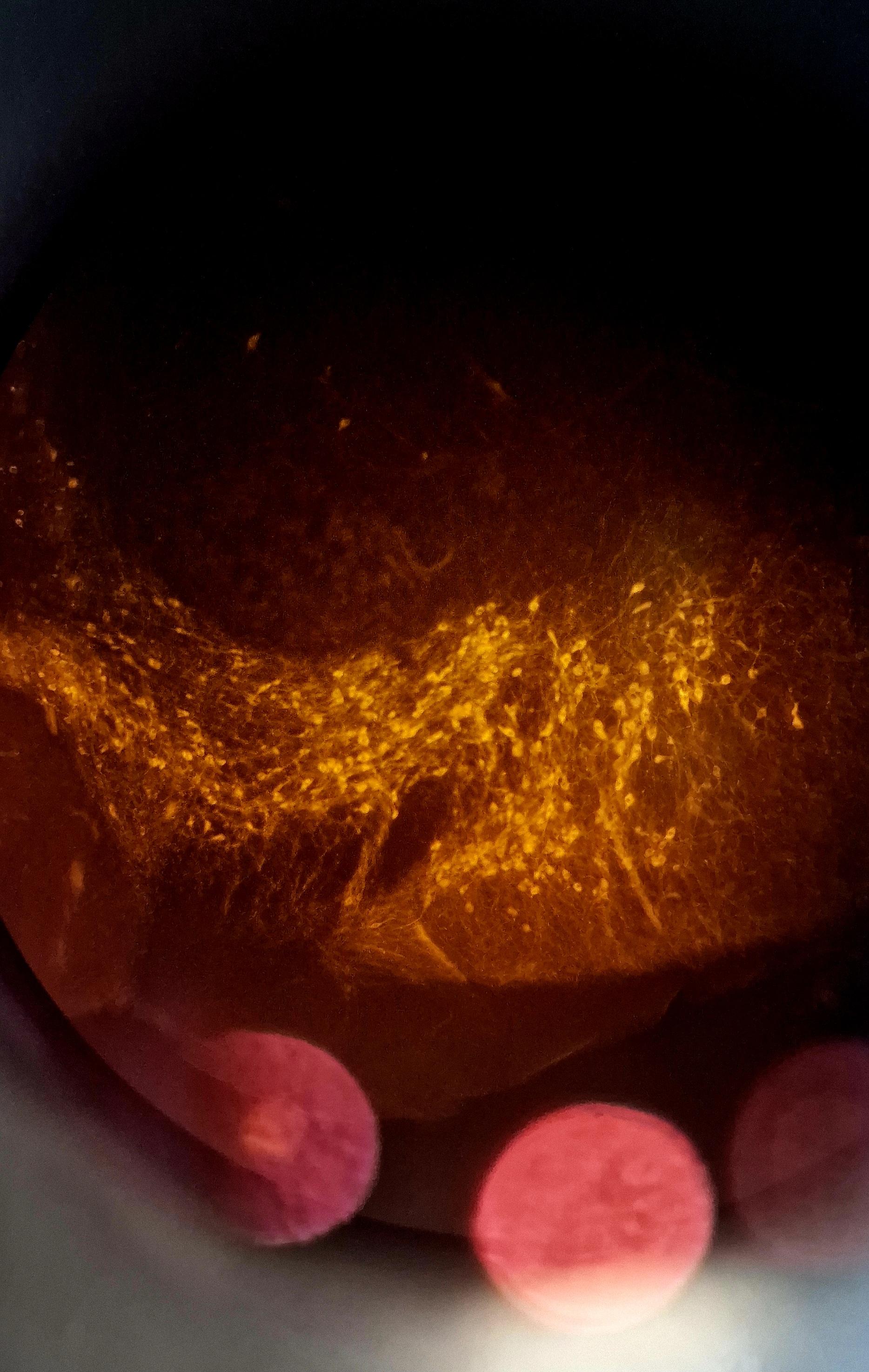 photo taken down an eyepiece of a microscope, showing orange glowing brain cells