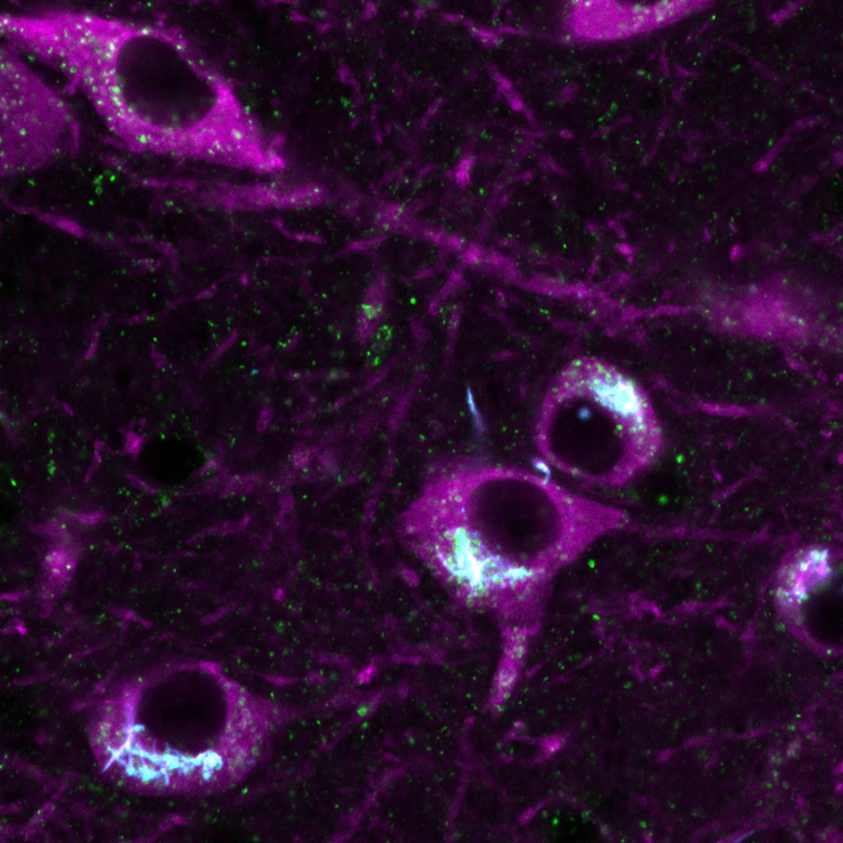 Dopamine neurons in the brain.